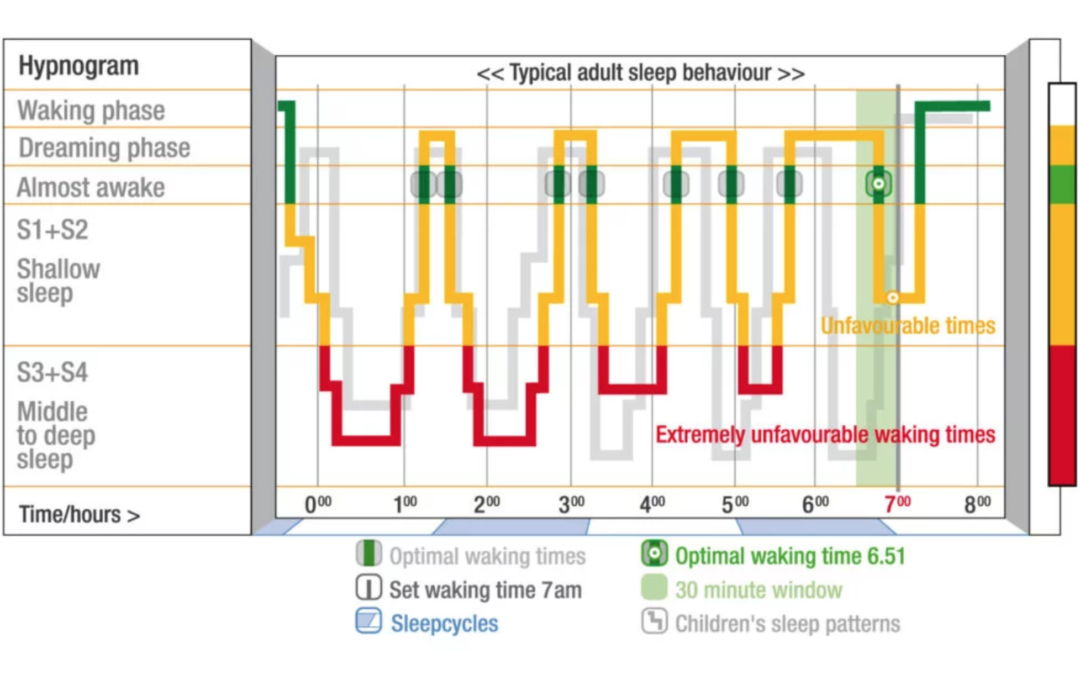 Do Sleep Trackers Improve Your Sleep?